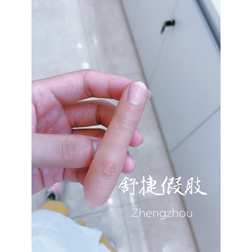 安裝假手指的接口如何處理比較好？