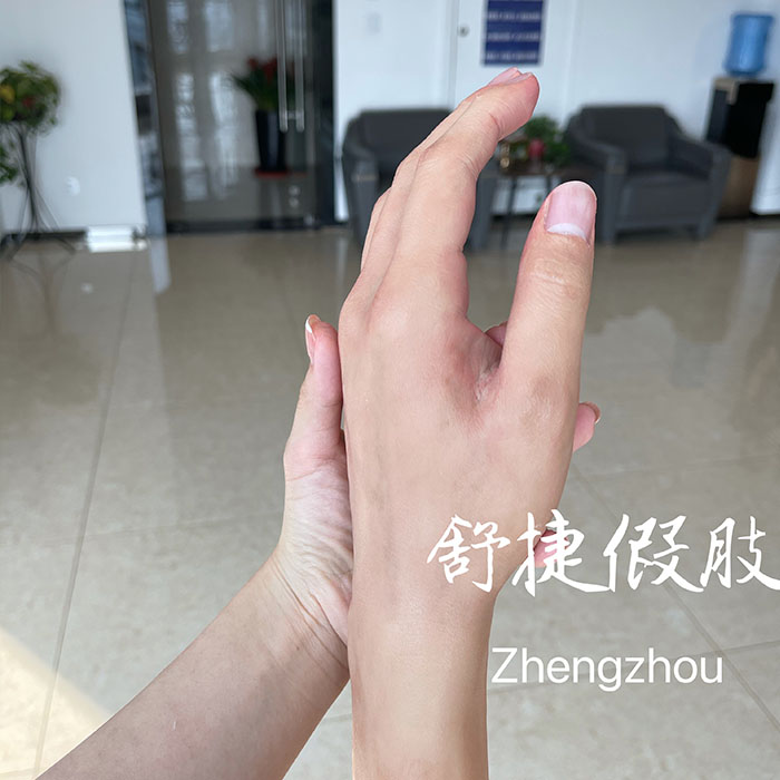 假手，美容假手