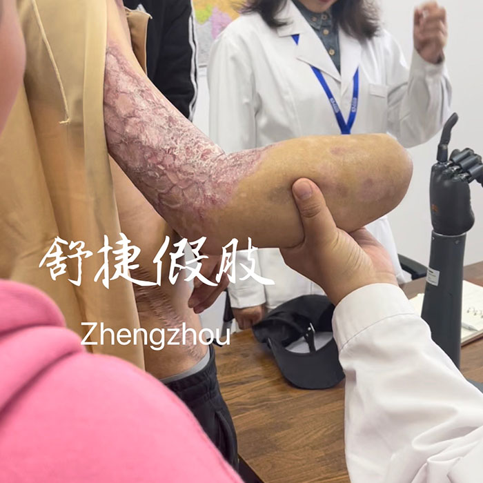 前臂假肢，智能手
