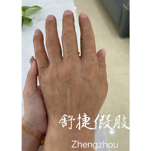 假肢手，高度仿真美容手