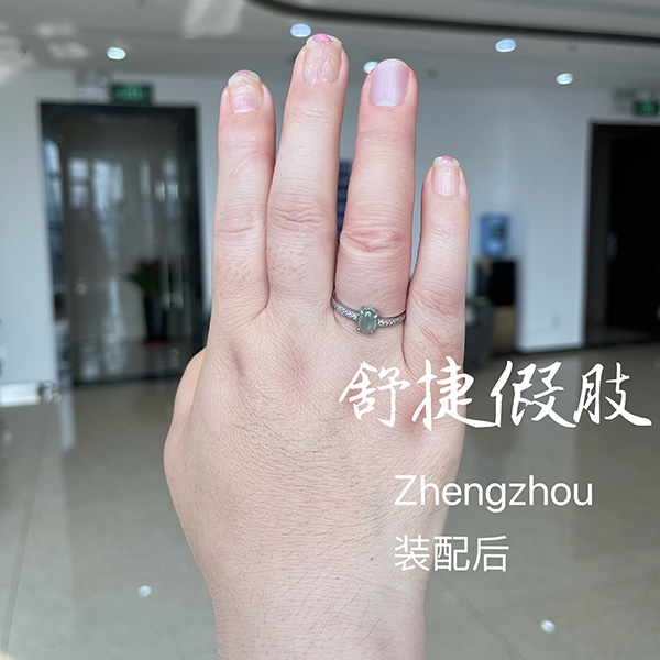 美容假手指裝配后效果，根本看不出來